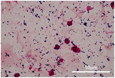 Case report: Methicillin-resistant Staphylococcus aureus with penicillin susceptible (PS-MRSA): first clinical report from a psychiatric hospital in China